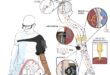 Local man receives first neuro-prosthetic knee: ‘A major milestone’