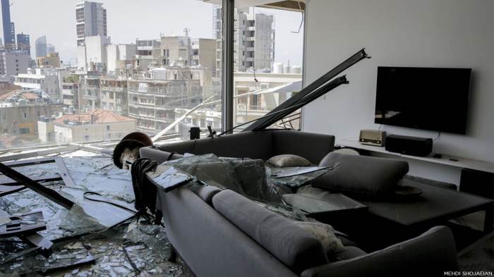 Beirut eye doctor describes 'devastating' injuries after blasts